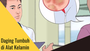 Obat Kutil Kelamin Pria Tradisional