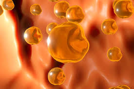 3 Blood Tests More Important Than Total Cholesterol | Best Cardiologist in Vadodara Explains Heart Risk