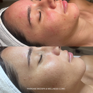 VIP Program Transformation