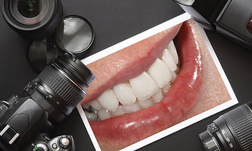 Intraoral Photography dental treatment at Dr. Sonam Rambhia DDS in Tulare CA