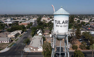 Find a Dentist in Tulare, CA dental treatment at Dr. Sonam Rambhia DDS in Tulare CA