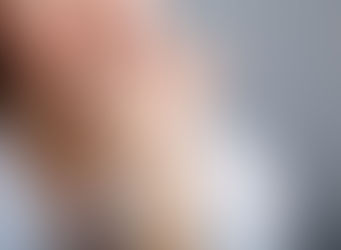 Woman chews on skin around fingernails