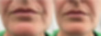 ree