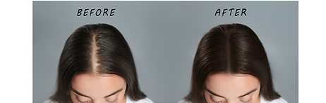 Before & After Hair Treatments