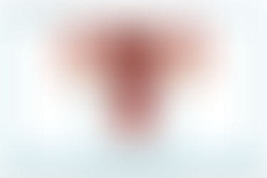 How Do Fibroids Form?