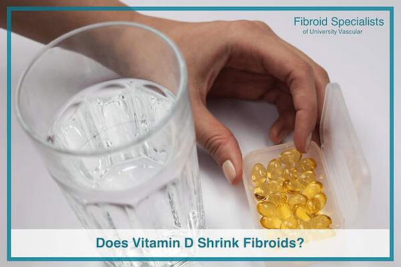 Can Vitamin D Shrink Fibroids? Evidence & FAQs