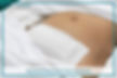 pictures of stomach after hysterectomy scar