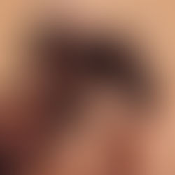 Unlocking Beauty from Within: The Crucial Role of Gut and Hormone Health