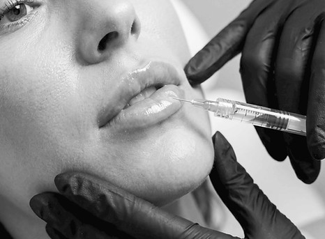 Best lip filler nashville med spa cosmetic injections