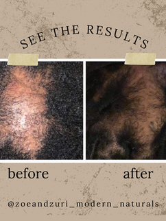 Before using Haitian Castor Oil – hair showing breakage and thinning