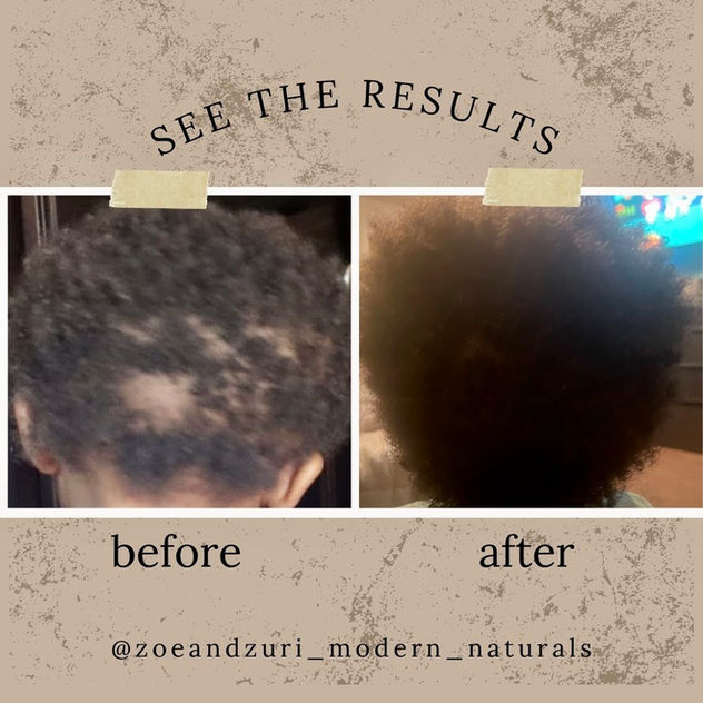 Haitian Black Castor Oil Before and After