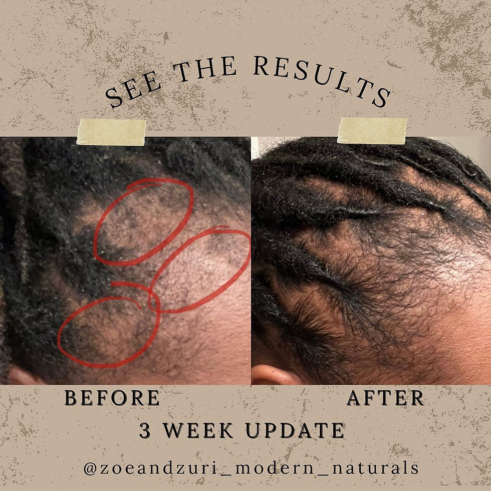 Before and after results showing Haitian black castor oil benefits for loc regrowth and scalp restoration