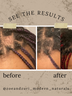 Before using Haitian Castor Oil – hair showing breakage and thinning