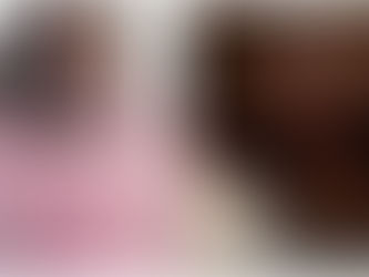 El rapero Lil Uzi Ver se implanta un diamante en la frente y sus fan se lo arrancan