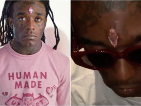 El rapero Lil Uzi Ver se implanta un diamante en la frente y sus fan se lo arrancan