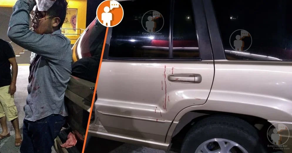 #Morelia: Intentan robarle su carro pero tenía cortacorrientes; le dieron tres cachazos en la cabeza