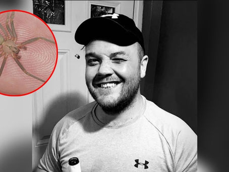 Muere hombre tras ser picado por una araña venenosa que compró por internet, era su mascota