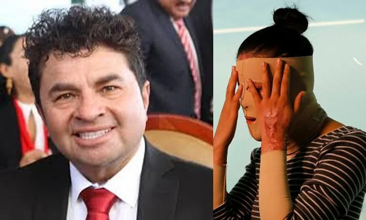 #ÚltimaHora: Detienen a agresor de saxofonista oaxaqueña atacada con ácido