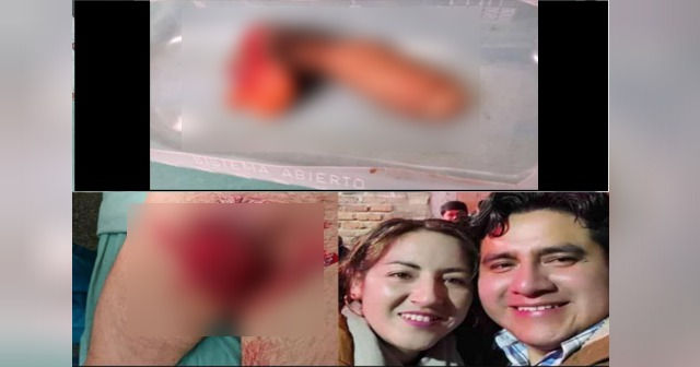 Investigan a una mujer que mutiló la parte íntima de su pareja mientras dormía por celos