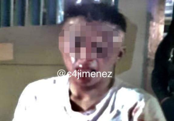 México: Usuarios de transporte público le dejan el rostro irreconocible a un ratero (+Foto)