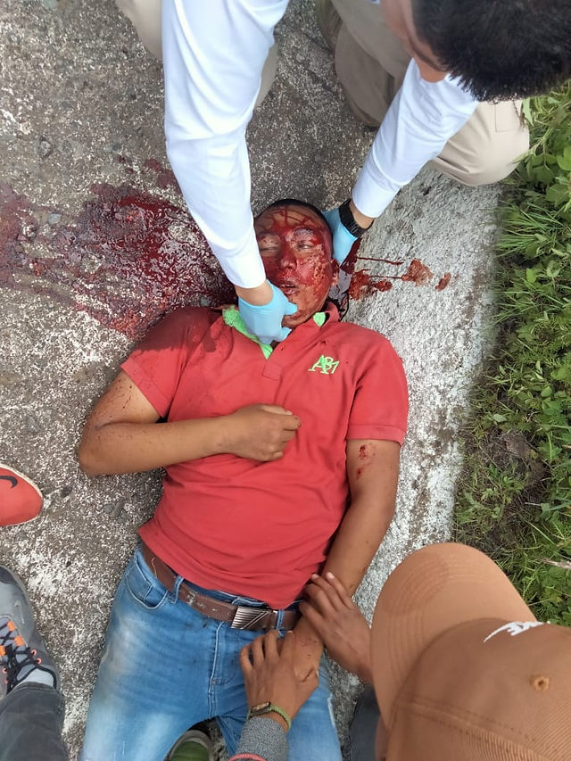 Autobús atropella a normalista que "boteaba" en la Morelia-Pátzcuaro