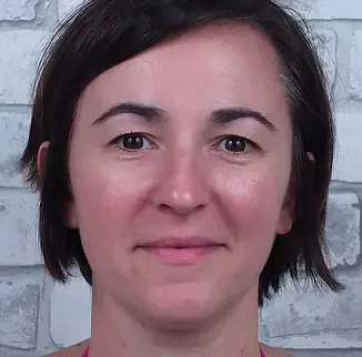 avant-apres cosmétique