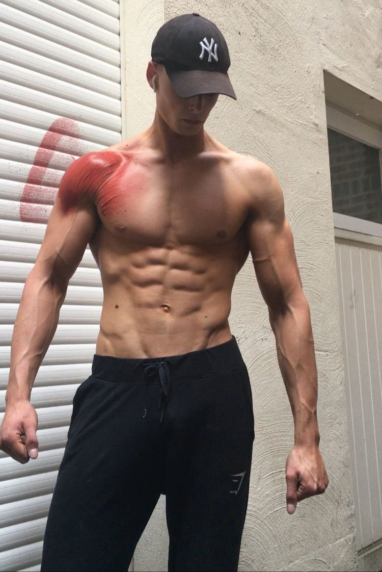 The Smart Lifter’s Injury Map: What Usually Goes Wrong, and Why
