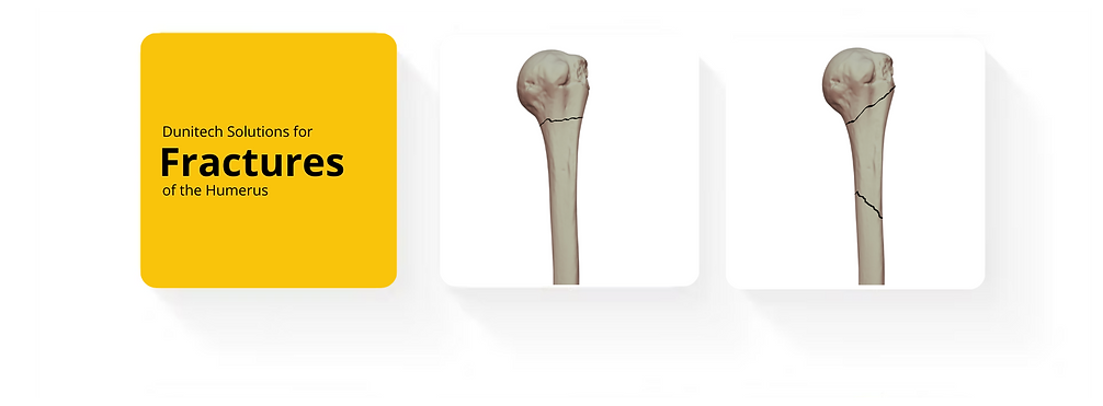 NUNA Humerus (5).png