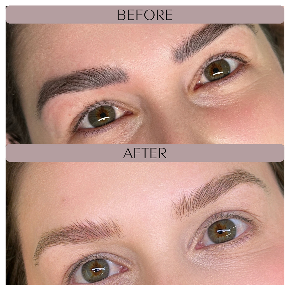 Before and after photos of client showing gradual fading of eyebrow tattoo