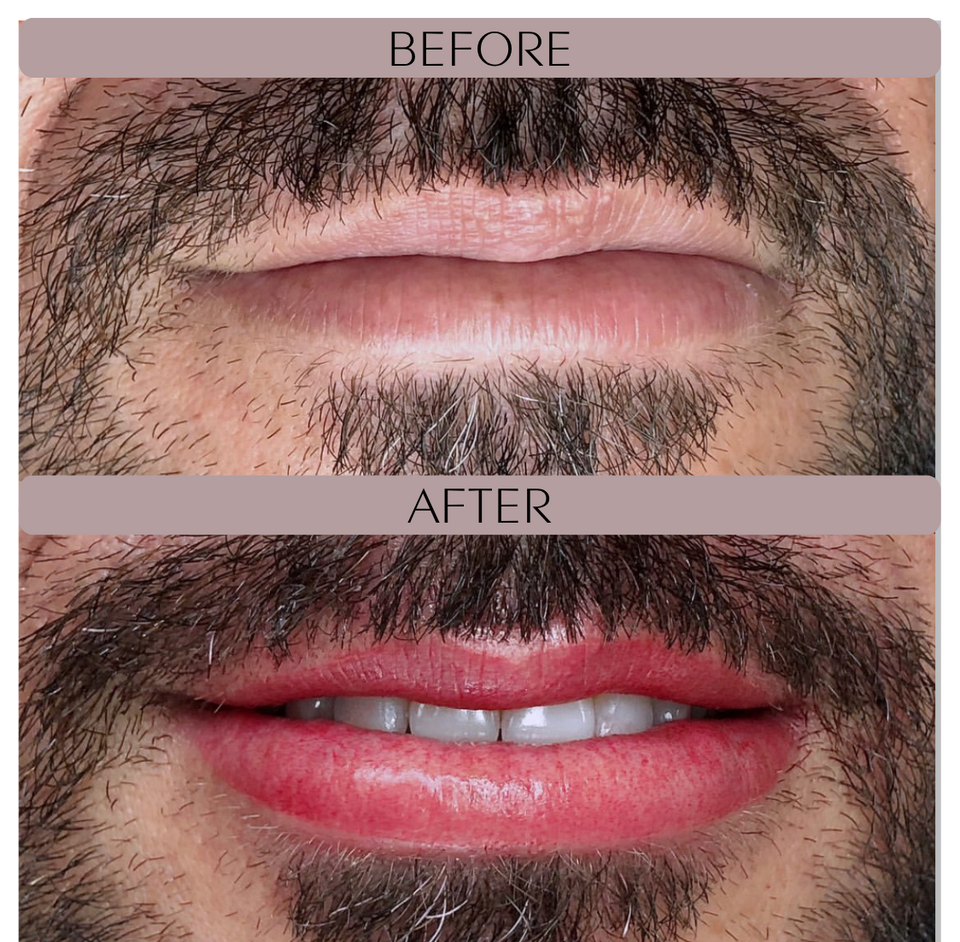 Before and after photos of client with natural pink lip tone after lip blushing