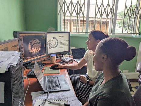 Training Malawi’s First Radiologists: Olive’s Experience in the Radiology MMed Programme
