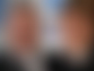 העליון אימץ החלטת המחוזי: ערבות מיליון שקל בסכסוך של 3 מיליון שקל