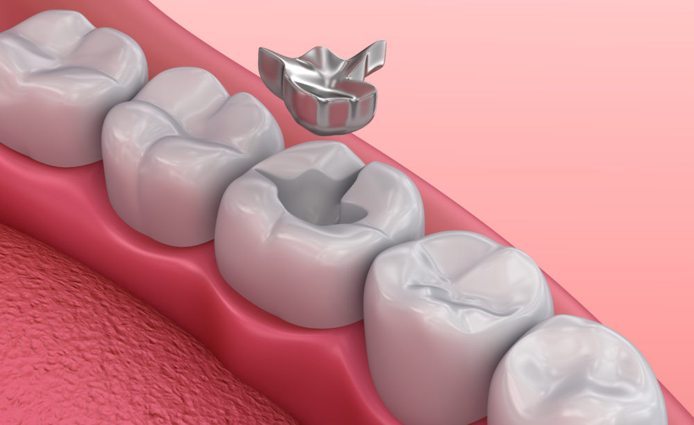 higiene dental
