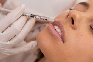 close-up-woman-getting-lip-filler-with-injection.jpg