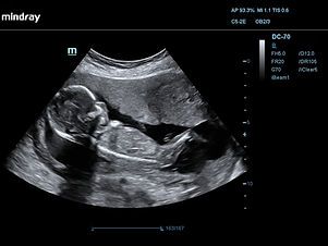 black and white ultrasound