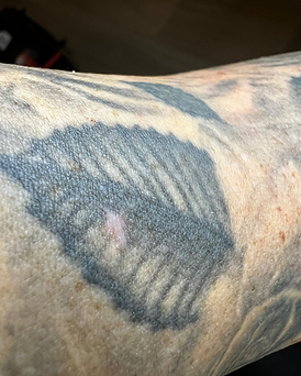 Tattoo Narbe