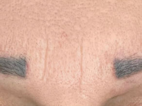 bläulich wirkende Augenbrauen