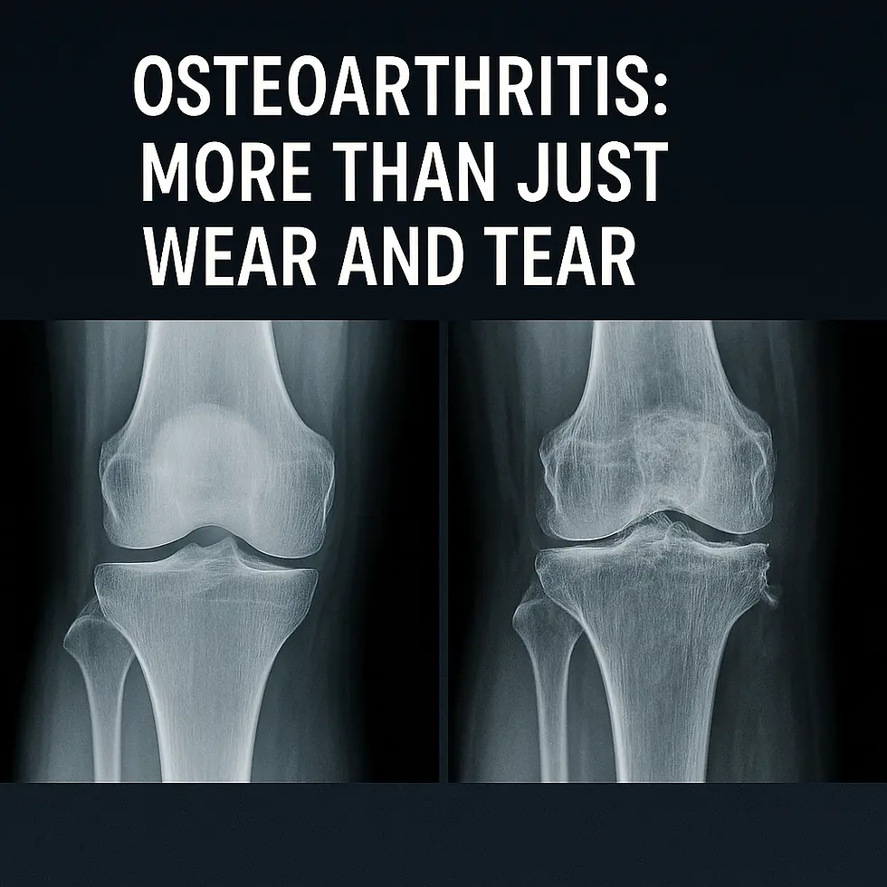 What is Osteoarthritis for Nursing Students in Alberta.
