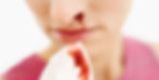 Wound Care, how to treat a Nosebleed properly.