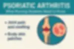 What is Psoriatic Arthritis? Nursing students review in Alberta.