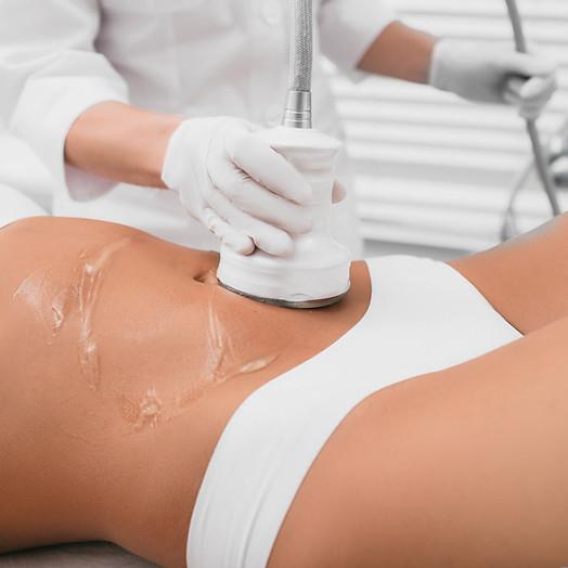 cavitation treatment.jpeg