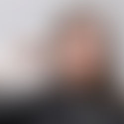 Conheça 4 principais dúvidas sobre o botox aplicado por dentistas