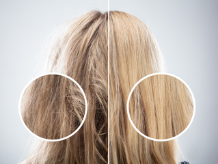 8 Reasons Your Hair Follicles Have “Stalled” — And How To Wake Them Back Up