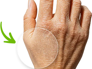 7 Warning SignSof Low Zinc for Women over 40 (One of Them is Dry Skin)