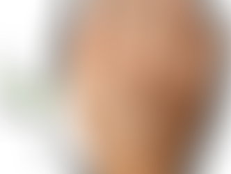 7 Warning SignSof Low Zinc for Women over 40 (One of Them is Dry Skin)