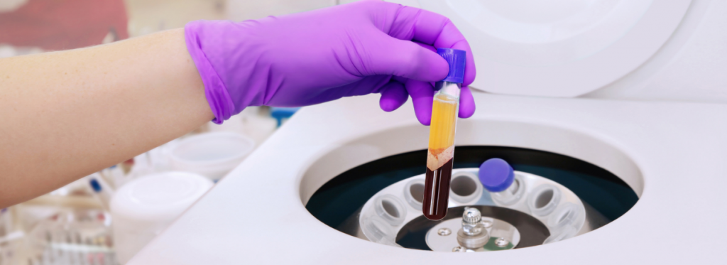 PRP terapia celular convencional