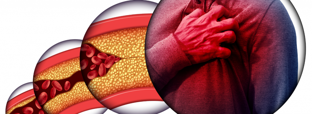 células-tronco e coração