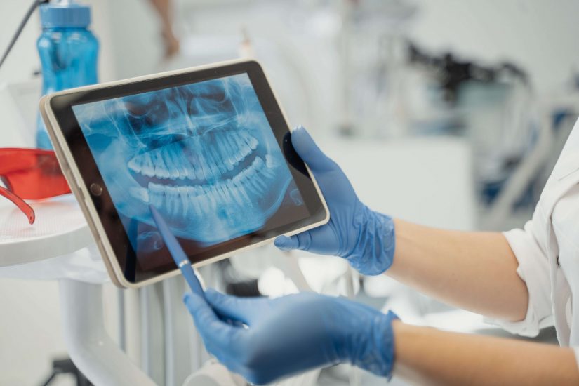 doença periodontal 