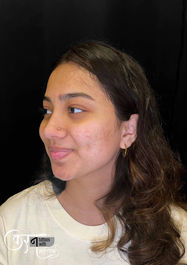 Nose stud piercing Sundernagar