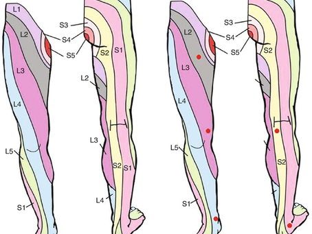 Lower back and lower extremity pain may be associated with problems in the corresponding myotomes.